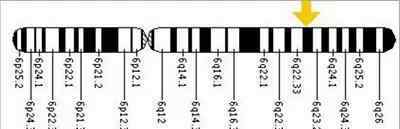 精氨酸酶 精氨酸酶缺乏症（Arginase deficiency）