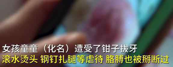 6岁被虐女童姥姥发声 到底说了什么