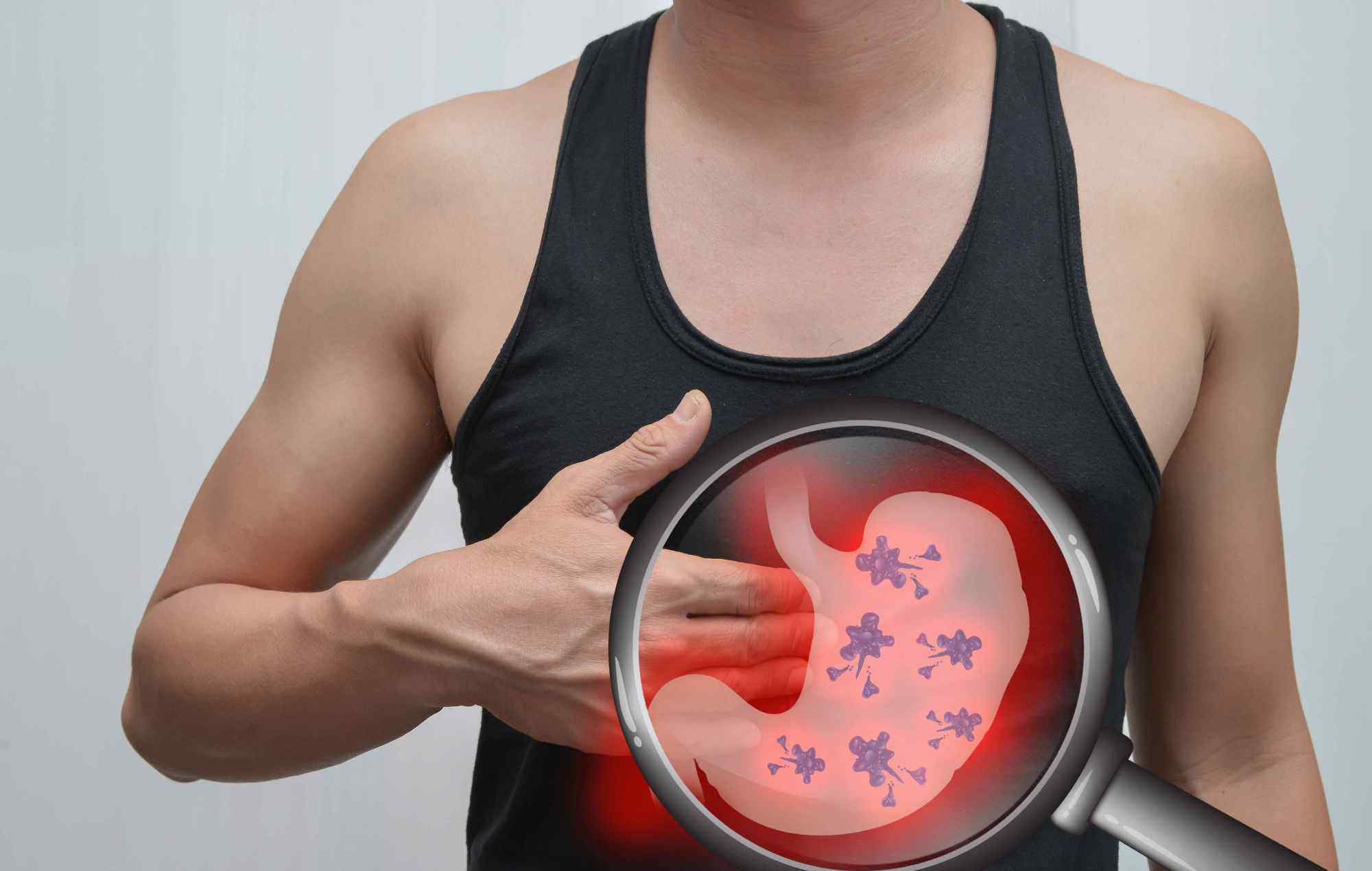 浅表性胃炎的治疗 浅表性胃炎不简单，这些症状可以初步判断，两个方法可治疗