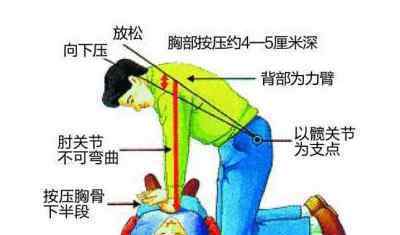 压断肋骨救回朋友 究竟是怎么一回事?