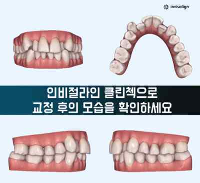 牙齿医院 在韩国看牙是一种怎样的体验