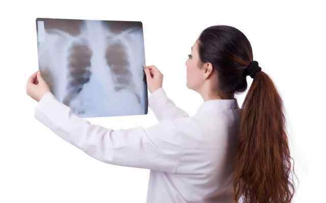 胸膜增厚是肺癌早期吗 没有得过肺癌的人，为什么胸膜会增厚而且还有积液？