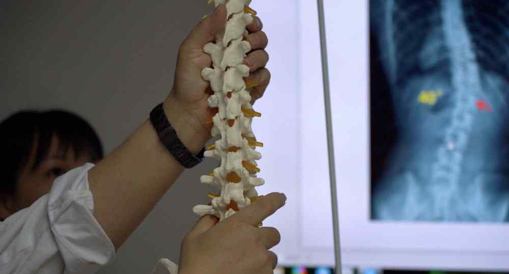 脊柱侧弯手术 男孩脊柱侧弯83度，手术后长高6厘米；专家称若治疗不当会加重