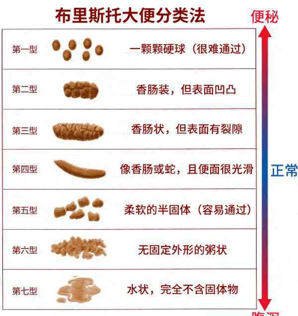 大便不成型 大便不成形一定是肠癌吗？别慌，医生告诉你怎么办！