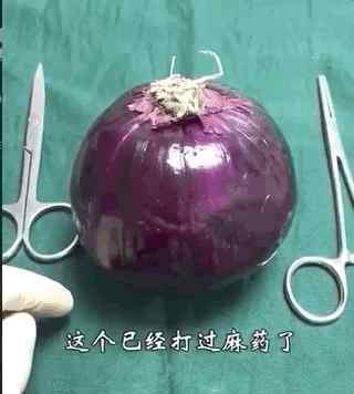 剖腹产手术视频 剖宫产全过程视频曝光，朋友圈男人炸了：“就这还嫌疼？”