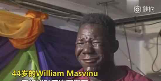 世界最丑的男人 世界最丑男人William Masvinu资料照片