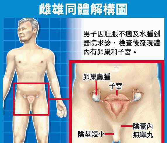 双性人下体什么样 男子发现自己来月经是女儿身，双性人下体到底是什么样？男子发现自己来月经是女儿身，双性人下体到底是什么样？