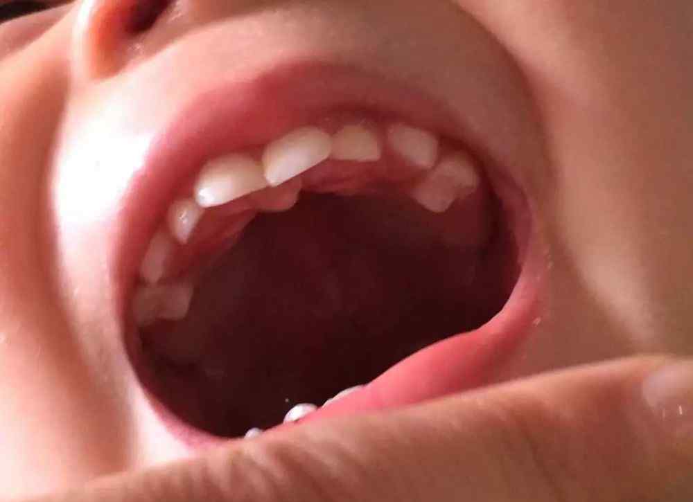 宝宝长牙图片最初图 详解：宝宝的长牙时间，一张图让你秒懂宝宝长牙顺序