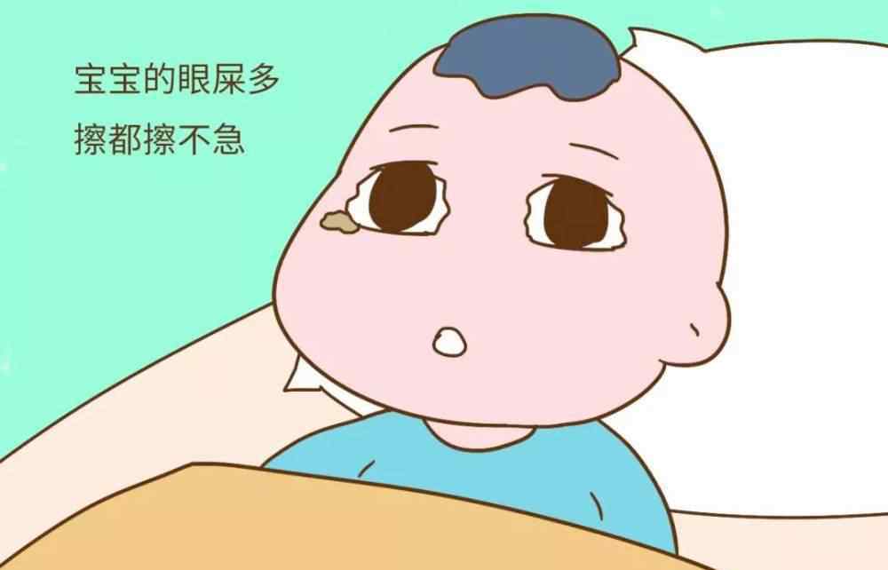 婴儿眼屎多是什么原因 宝宝眼屎多，是什么情况？