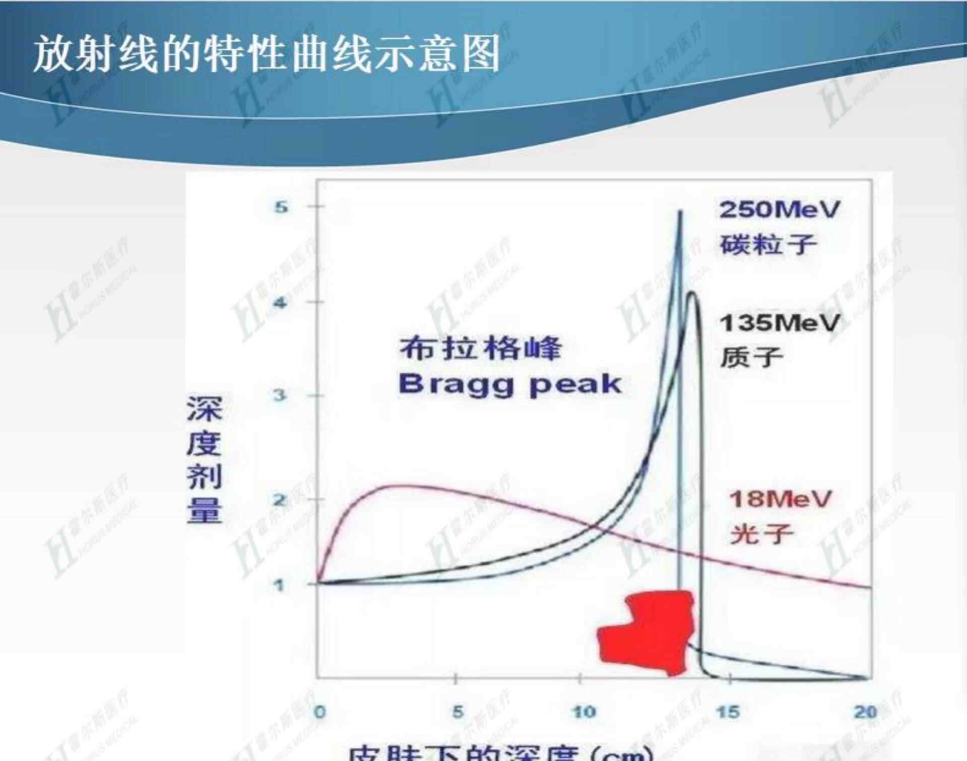 宋世鹏 质子治疗，病人的福音还是谎言？